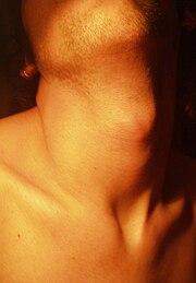 180px-Male_neck.jpg