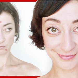 TIPPS+HAUT+WIMMERL: Pickel weg über Nacht! ES FUNKTIONIERT :D (DE 2015)