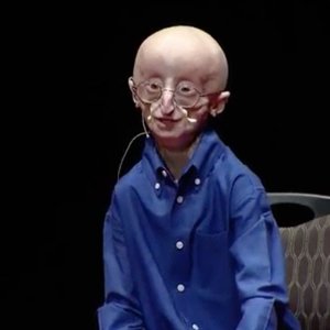 VORTRAG+LEBEN+TOD+KRANKHEIT+GENMUTATION: My Philosophy for a Happy Life | Sam Berns | TEDxMidAtlantic (US 2013)