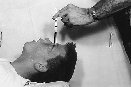 howard_dully_icepick_lobotomy_1960.jpg.3034625.jpg