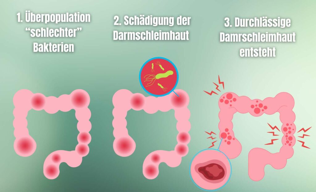leaky-gut-1024x621.jpg